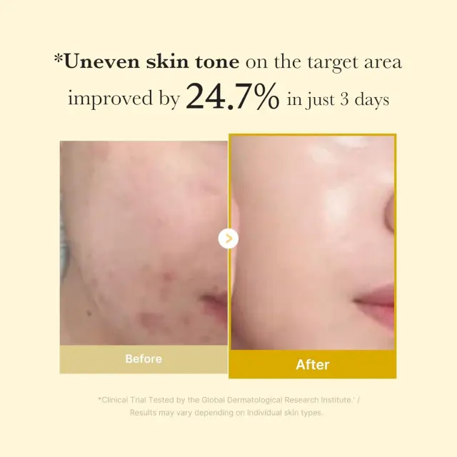 Medicube Kojic Acid Turmeric Wrapping Mask – view 4