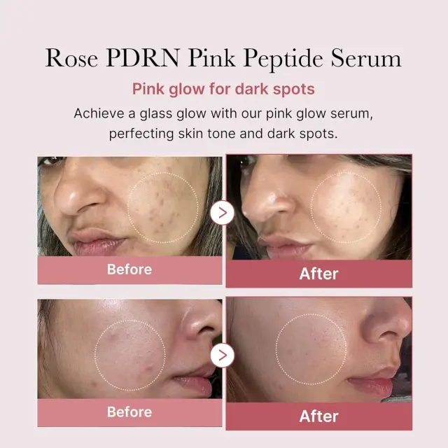 Medicube Salmon DNA PDRN Pink Peptide Serum – view 3