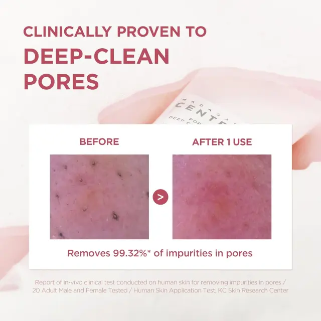 SKIN1004 Deep Facial Cleansing Foam – view 3